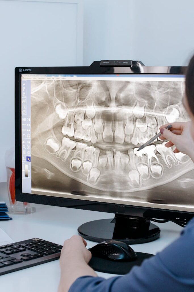 close up shot of a person pointing at the xray image on the computer screen